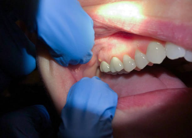  Corrigan, TX Emergency Dentist Pros